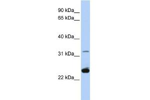 WB Suggested Anti-PLP1 Antibody Titration:  0.