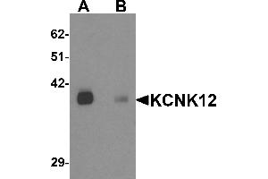 Western blot analysis of KCNK12 in rat brain tissue lysate with KCNK12 antibody at 0. (KCNK12 anticorps  (C-Term))