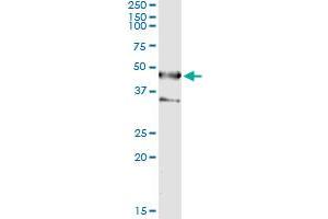 Immunoprecipitation of SEPT1 transfected lysate using anti-SEPT1 monoclonal antibody and Protein A Magnetic Bead , and immunoblotted with SEPT1 MaxPab rabbit polyclonal antibody. (Septin 1 anticorps  (AA 1-367))