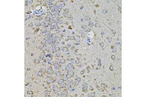 Immunohistochemistry of paraffin-embedded mouse brain using SPP1 antibody (ABIN1874927) at dilution of 1:100 (40x lens).