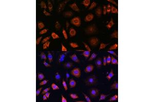 Immunofluorescence analysis of L929 cells using PFDN4 antibody (ABIN7269508) at dilution of 1:100.