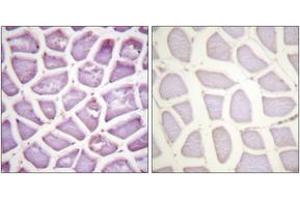 Immunohistochemistry analysis of paraffin-embedded human skeletal muscle, using Parkin (Phospho-Ser131) Antibody.