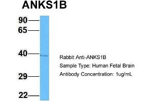 Host: Rabbit Target Name: ANKS1B Sample Type: Human Fetal Brain Antibody Dilution: 1.