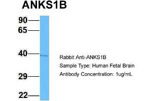 Host: Rabbit Target Name: ANKS1B Sample Type: Human Fetal Brain Antibody Dilution: 1. (ANKS1B anticorps  (C-Term))