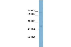 WB Suggested Anti-GPD2 Antibody Titration:  0. (GPD2 anticorps  (Middle Region))