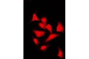 Immunofluorescent analysis of Spot 14 staining in U2OS cells. (THRSP anticorps)