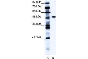 WB Suggested Anti-ZNF541 Antibody Titration: 1. (ZNF541 anticorps  (Middle Region))