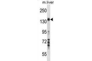 Western Blotting (WB) image for anti-Mitogen-Activated Protein Kinase Kinase Kinase 1 (MAP3K1) antibody (ABIN2998117) (MAP3K1 anticorps)