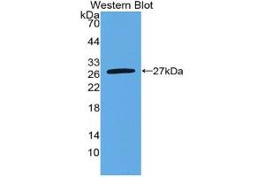 Western blot analysis of the recombinant protein. (Nephrin anticorps  (AA 27-234))
