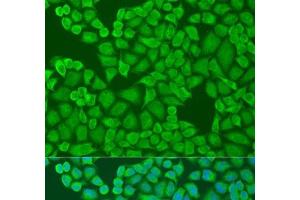 Immunofluorescence analysis of U2OS cells using IFI44 Polyclonal Antibody at dilution of 1:100.