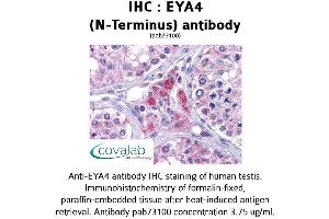 Image no. 2 for anti-Eyes Absent Homolog 4 (EYA4) (N-Term) antibody (ABIN1734196) (EYA4 anticorps  (N-Term))