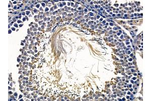 ABIN6258269 and ABIN6273857 at 1/100 staining rat testis tissue by IHC-P. (GPR15 anticorps  (C-Term))