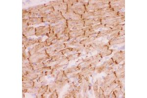Anti-Desmin Picoband antibody,  IHC(F): Rat Cardiac Muscle Tissue