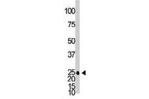 The GJB2 polyclonal antibody  is used in Western blot to detect GJB2 in mouse brain tissue lysate. (GJB2 anticorps  (C-Term))