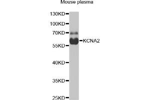 Western blot analysis of extracts of mouse plasma, using KCN antibody (ABIN6129438, ABIN6142695, ABIN6142696 and ABIN6221897) at 1:1000 dilution.