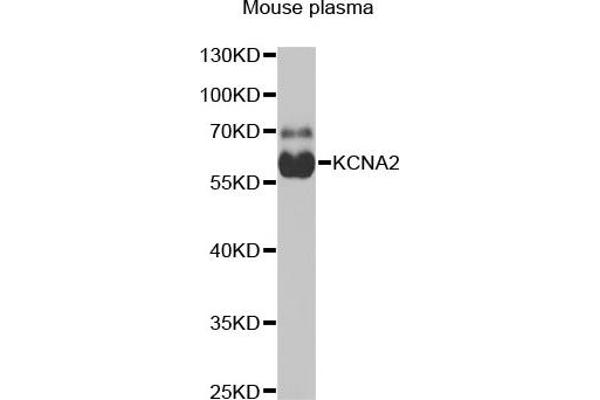 KCNA2 anticorps  (AA 1-165)