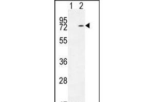 Western blot analysis of KARS (arrow) using rabbit polyclonal KARS Antibody (N-term) (ABIN655049 and ABIN2844677). (KARS anticorps  (N-Term))
