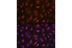 Immunofluorescence analysis of U2OS cells using CETN3 antibody (ABIN7268452) at dilution of 1:100.