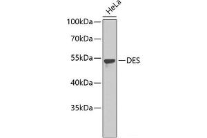 Western blot analysis of extracts of HeLa cells using DES Polyclonal Antibody. (Desmin anticorps)