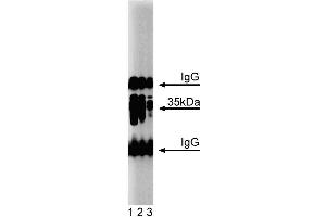 Western blot analysis of Arginase I on a mouse liver lysate. (Liver Arginase anticorps  (AA 53-207))