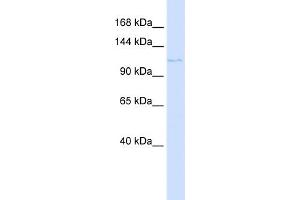 WB Suggested Anti-PTCH2 Antibody Titration:  0. (Patched 2 anticorps  (N-Term))
