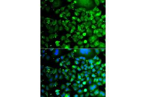 Immunofluorescence analysis of A549 cell using MOCS3 antibody. (MOCS3 anticorps)