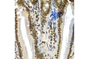 Immunohistochemistry of paraffin-embedded mouse Intestine using SF3B2 antibody.