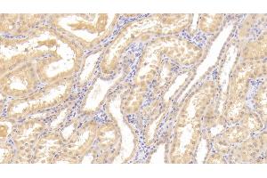 anti-tyrosine Kinase with Immunoglobulin-Like and EGF-Like Domains 1 (TIE1) (AA 435-609) antibody