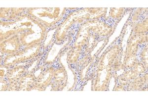 Detection of Tie1 in Human Kidney Tissue using Polyclonal Antibody to Tyrosine Kinase With Immunoglobulin Like And EGF Like Domains Protein 1 (Tie1)