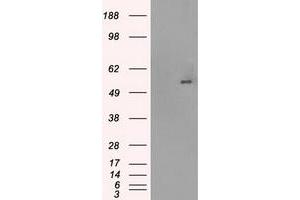 HEK293T cells were transfected with the pCMV6-ENTRY control (Left lane) or pCMV6-ENTRY SLC2A5 (Right lane) cDNA for 48 hrs and lysed.