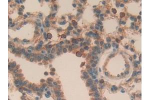 Detection of APOH in Mouse Lung Tissue using Polyclonal Antibody to Apolipoprotein H (APOH)