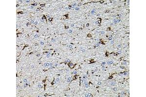 Immunohistochemistry of paraffin-embedded Rat brain using TRPA1 Polyclonal Antibody at dilution of 1:100 (40x lens). (TRPA1 anticorps)