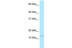 WB Suggested Anti-PFDN4 Antibody Titration: 1. (PFDN4 anticorps  (N-Term))