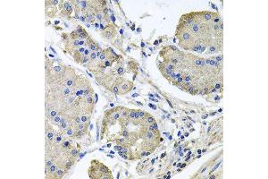 Immunohistochemistry of paraffin-embedded human stomach using NDUFA6 antibody (ABIN6003563) at dilution of 1/100 (40x lens). (NDUFA6 anticorps)