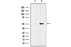 anti-Interferon-Induced Protein with Tetratricopeptide Repeats 5 (IFIT5) (Internal Region) antibody