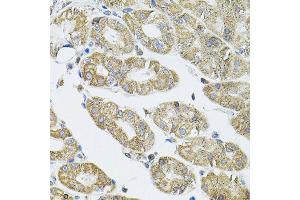 Immunohistochemistry of paraffin-embedded human stomach using VEPH1 antibody (ABIN5974616) (40x lens). (VEPH1 anticorps)