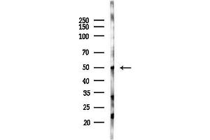 anti-Inhibin, beta A (INHBA) (Internal Region) antibody