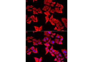 Immunofluorescence analysis of U2OS cells using THRSP antibody (ABIN5974357). (THRSP anticorps)