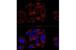 Confocal immunofluorescence analysis of U2OS cells using GCSH antibody (ABIN6127983, ABIN6141032, ABIN6141033 and ABIN6217784) at dilution of 1:100 (60x lens). (GCSH anticorps  (AA 1-173))