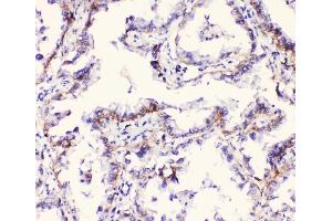 IHC analysis of Integrin alpha 3 using anti-Integrin alpha 3 antibody (ABIN6719410). (ITGA3 anticorps)