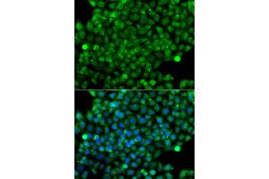 Immunofluorescence analysis of A549 cells using CFHR3 antibody (ABIN6294036).