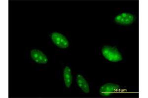 Immunofluorescence of purified MaxPab antibody to C2orf3 on HeLa cell. (GCFC2 anticorps  (AA 1-215))