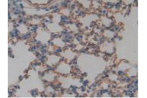 IHC-P analysis of Mouse Lung Tissue, with DAB staining. (Thrombomodulin anticorps  (AA 31-167))