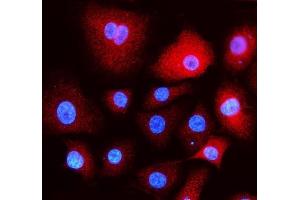 IF analysis of EEA1 using anti- EEA1 antibody (ABIN5692856). (EEA1 anticorps)