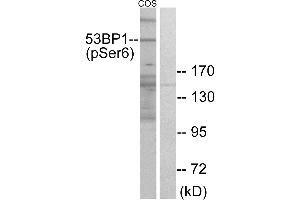 Immunohistochemistry analysis of paraffin-embedded human heart tissue using 53BP1 (Phospho-Ser6) antibody.