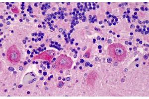 Human  Brain, Cerebellum: Formalin-Fixed, Paraffin-Embedded (FFPE) (GPR77 anticorps  (AA 1-50))