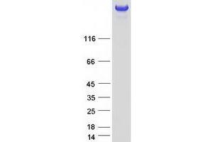 Validation with Western Blot
