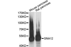 Western blot analysis of extracts of various cell lines, using GNA12 antibody (ABIN6292955) at 1:3000 dilution. (GNA12 anticorps)