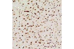 Immunohistochemical analysis of NF-kappaB p65 staining in rat brain  formalin fixed paraffin embedded tissue section. (NF-kB p65 anticorps)