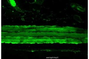 Immunohistochemistry analysis using Mouse Anti-Hsp27 Monoclonal Antibody, Clone 8A7 (ABIN361755 and ABIN361756).